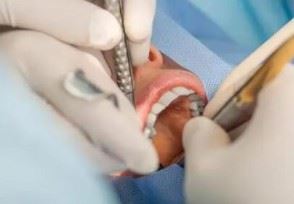 治疗牙齿可以报销吗 种植牙齿多少钱一颗？