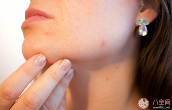 长期使用水杨酸会对皮肤有什么危害吗 刷酸注意事项