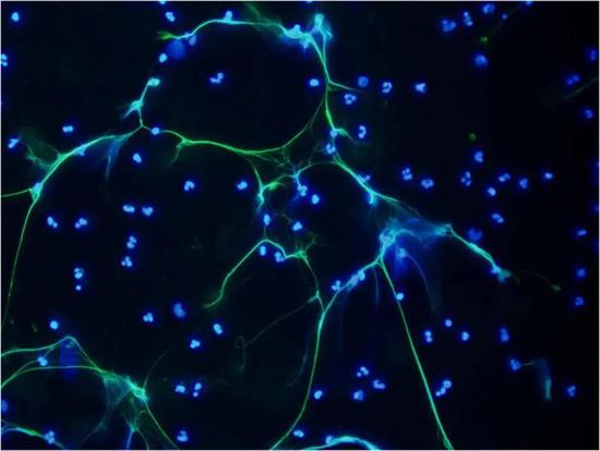 NETs荧光显微镜图（40倍镜）绿色为NETs，蓝色为细胞核[19]