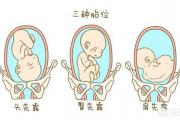 孕妇做胎儿监护时应注意的事项是什么？