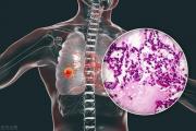 右肺腺癌是种很难治的病吗？