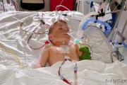 重度窒息的新生儿抢救过来会得脑瘫吗？